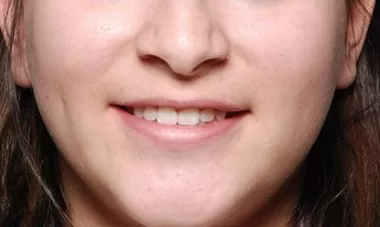 Bakirkoy Dis Doktoru 1