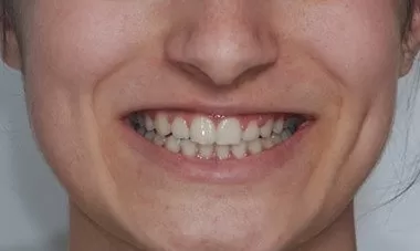 Bakirkoy Dis Doktoru Randevu 1