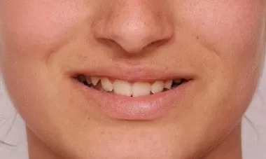 Bakirkoy Dis Doktoru Tavsiye 1