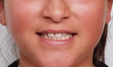 Bakirkoy Dis Klinigi 1