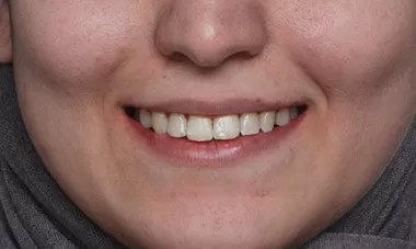 Bakirkoy Ortodonti Uzmani