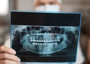 Dental Radyoloji Fiyatları