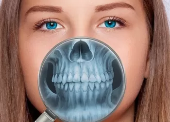 Dental Volumetrik Tomografi Nasıl Çekilir?