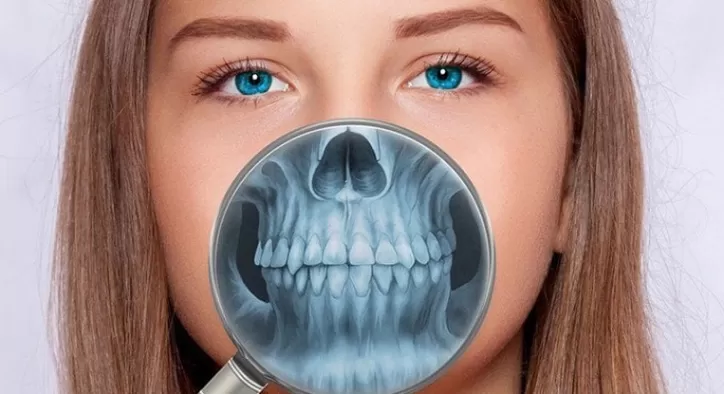 Dental Volumetrik Tomografi Nasıl Çekilir?