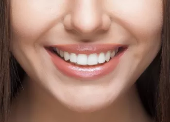 Diş Estetiği (Gingivoplasti)