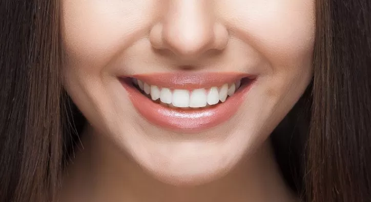 Diş Estetiği (Gingivoplasti)