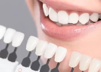 Diş Kaplama Çeşitleri