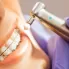 Diş Teli Tedavisi Aşamaları