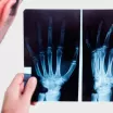 El Bilek Radyografisi Nasıl Çekilir?