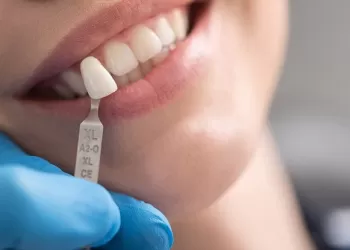 Full Porselenler (Empress) - Porselen Diş Kaplama