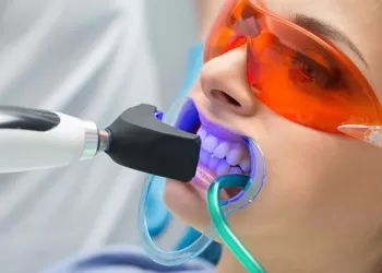 Kombine Diş Beyazlatma Nedir?