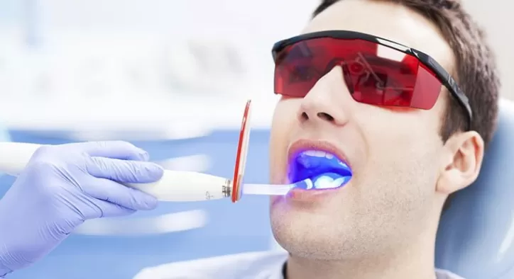 Lazerli Diş Tedavisi Nasıl Yapılır?