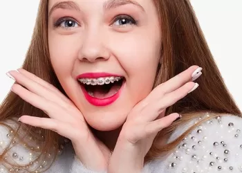 Metal Diş Teli - Hızlı ve Etkili