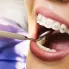 Ortodontik Tedavide Diş Çekilir Mi?