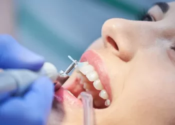 Polisaj Nasıl Yapılır?