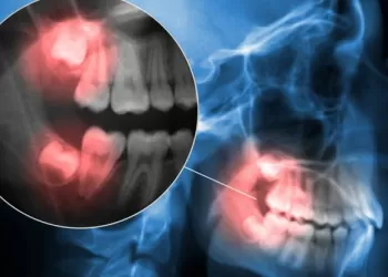 Sefalometrik Film Nasıl Çekilir?