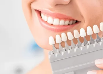 Tek Diş Beyazlatma Nasıl Yapılır?