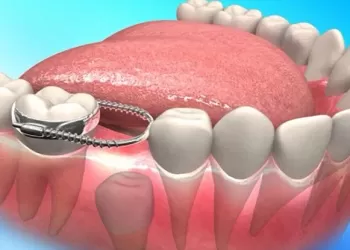Çocuklar İçin Yer Tutucular - Eksik Dişler İçin Önlem