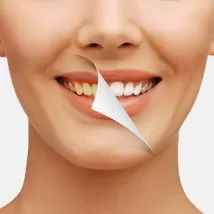 Sararmış Dişler Kabusunuz Mu Oluyor?