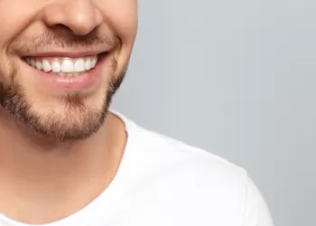 Diş Beyazlatma Kalıcı mıdır?