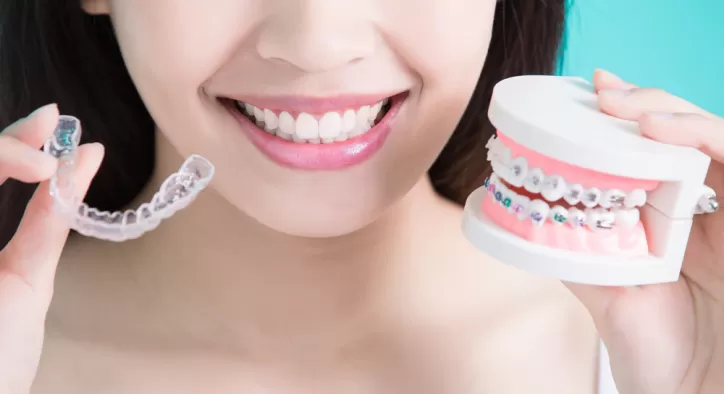 Diş Teli ile İnvisalign Şeffaf Plak Tedavisi Karşılaştırması