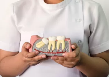 Gömülü Diş Tedavisi ve Çekimi