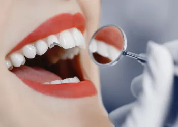 Kırık Diş Tedavisi Yöntemleri Nelerdir?