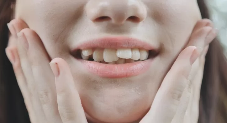 Dişler Neden Çapraşık Olur?