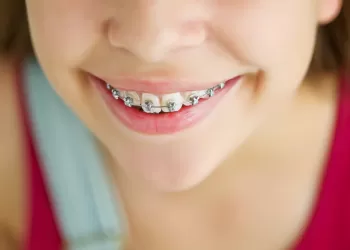Ortodonti Hakkında Doğru Bilinen Yanlışlar