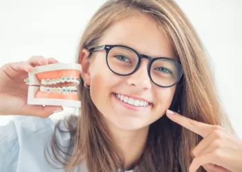 Ortodontik Apareyler - Sabit ve Hareketli Apareyler